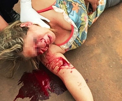 Mulher sofre ferimentos no rosto após acidente no Jardim Flamboyant