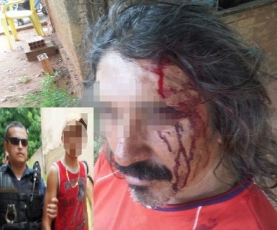 Sem motivos, neto agride o avô com banco de madeira e acaba apreendido pela polícia