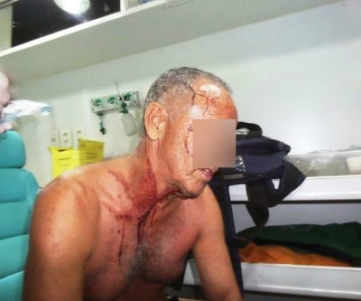 Homem leva coronhada na cabeça e fica ferido durante assalto 