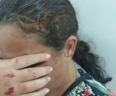 Mulher arremessa panela com óleo quente no marido e é agredida com bloco pela vítima