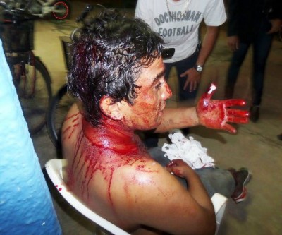 Jovem agredido na cabeça pede socorro em igreja evangélica no bairro Vila Nova 