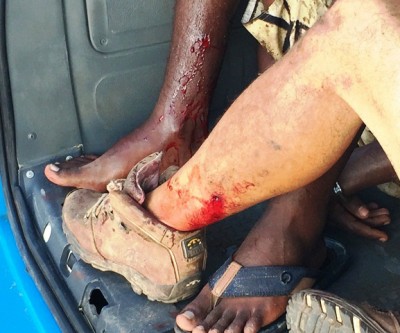 Perseguição policial acaba com dois feridos que foram baleados na perna 