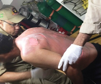 Mulher ateia fogo no marido após discussão em residência de Três Lagoas 