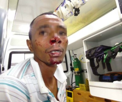 Deficiente físico é agredido em assalto na saída para Campo Grande 