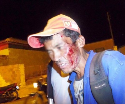 Ciclista cai, fica ferido, nega atendimento do SAMU e volta ao bar para tomar mais cachaça 