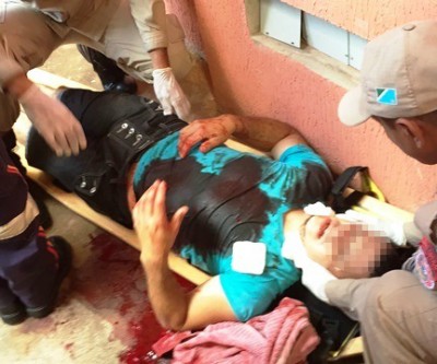 Jovem é baleado no pescoço em apartamento do Residencial Novo Oeste 