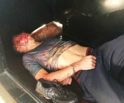 Assaltante espancado durante roubo a residência de servidor público é socorrido pela ROTAI 