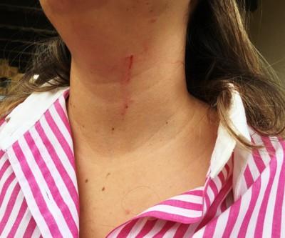 Professora universitária feita refém em assalto é agredida e amarrada no Jardim dos Ipês
