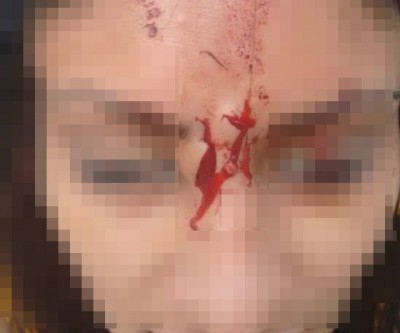Briga entre sogra e nora termina com a chegada da Polícia Militar 