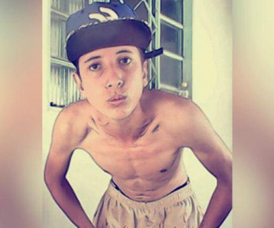 Após 09 dias, jovem que caiu de telhado quando fugia de festa morre no Auxiliadora 