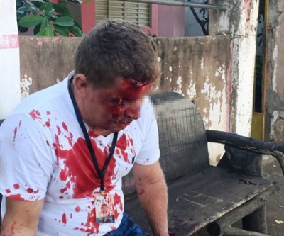 Manhã de domingo inicia com acidente grave na Rosário Congro 