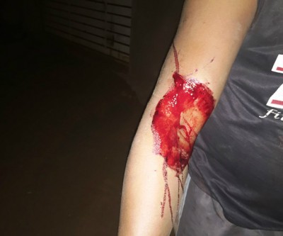 Para se defender de agressões, mulher esfaqueia o marido por duas vezes 