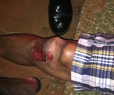 Idoso atropelado sofre fratura no joelho; motorista fugiu do local 