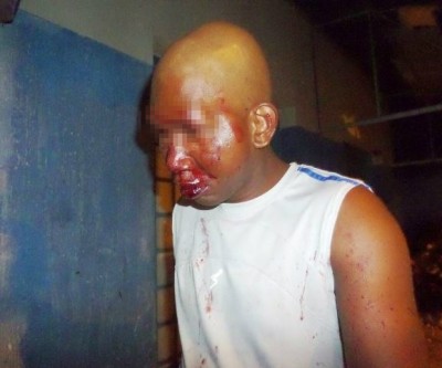 Haitiano é espancado por oito jovens quando passava por avenida de Três Lagoas 
