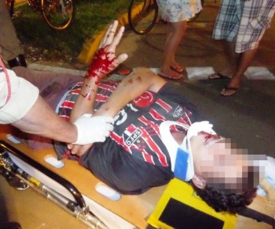  Ciclista bate em obstáculo na ciclovia e na queda, fica ferido no rosto e na mão  