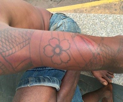 Após ser chamado de ladrão, bandidos “cobram a fita” e espancam acusado com pauladas 