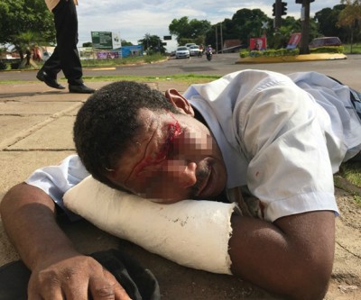 “Bebum” encontrado com corte na cabeça disse que foi agredido 