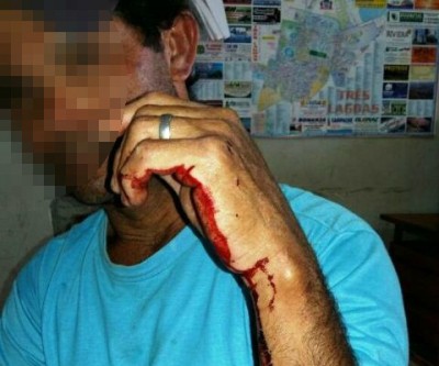 Ao cobrar satisfações do sobrinho sobre furto, Carpinteiro é agredido com barra de ferro