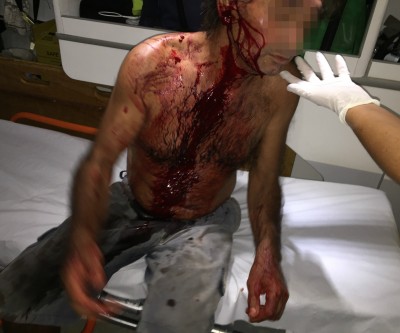Operador de máquina agredido com taco de sinuca é socorrido pelo SAMU 