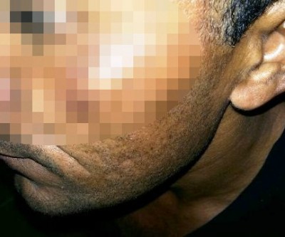 Construtor apanha de mulher com vassoura; polícia é chamada 