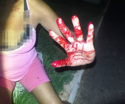 Para se defender de esfaqueamento, marido quebra “faca se serra” e deixa mulher ferida 