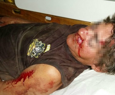 Ciclista que “cambaleava” na BR-262 é socorrido com traumatismo craniano 