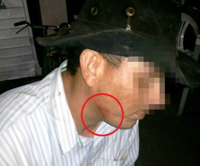 Ao salvar vítima de assalto, pintor leva tiro de raspão no queixo 