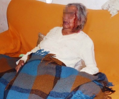 Bombeiros socorrem idosa de 82 anos que foi agredida pelo afilhado 