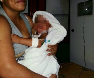Acidente doméstico causa queimaduras de 2º grau em criança de 1 ano