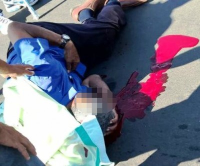 Ciclista fica gravemente ferido ao ser atingido por moto 