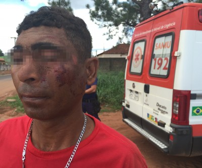“Bêbado” sofre queda, se machuca e nega atendimento do SAMU