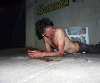 Homem que incomodou jogadores de sinuca é espancado em bar 