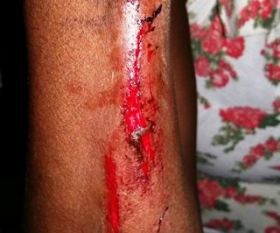 Filho que bateu na mãe ainda agrediu uma criança de 8 anos 