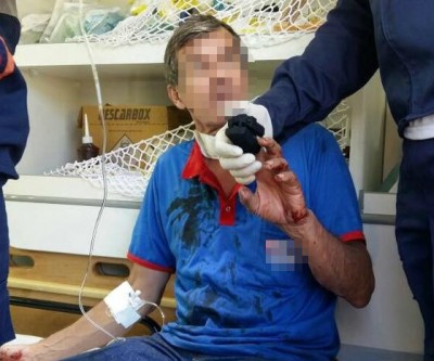 Linha com cerol enrosca no pescoço e fere motociclista no bairro Quinta da Lagoa