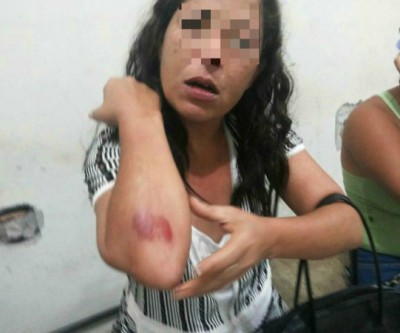 Ao voltarem de aniversário, casal briga e mulher é agredida com socos pelo marido 