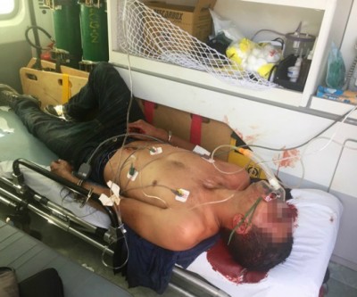 Assaltante baleado em roubo sai da UTI e passa bem
