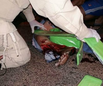 Idoso sofre fratura exposta ao ser atropelado por moto 