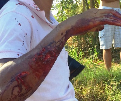  Jovem em moto sofre ferimentos graves ao bater em veículo no Jupiá 