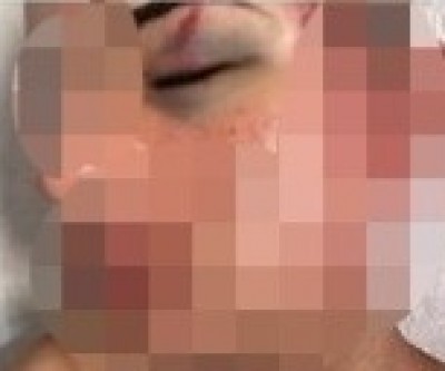Menor que participava de festa é espancado em suposto caso de homofobia 