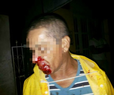 Acidente entre carro e bicicleta deixa ciclista ferido em Três Lagoas 