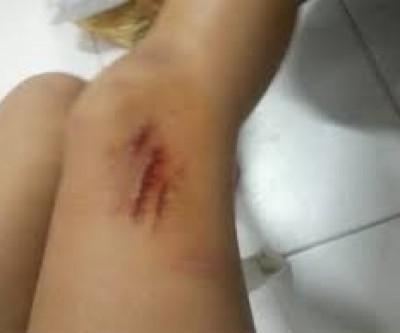 Para não ser morta, mulher precisa pular muro e pedir por socorro na casa do vizinho