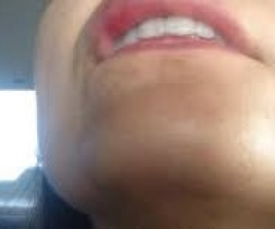 Mulher morde braço do marido para não ser amarrada com corda 