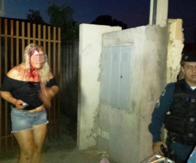 Mulher leva “capacetada” do marido após briga causada por moto 