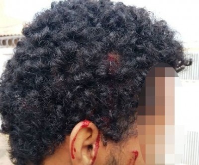 Jovem é agredido com barra de ferro e pedaço de pau 