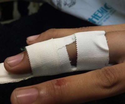 Mulher sofre suposta fratura no dedo após ser agredida pelo marido 