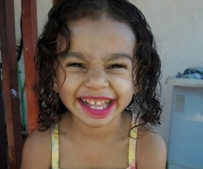 Menina de 3 anos que teve perna amputada em acidente recebe alta