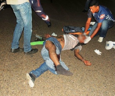 Acidente deixa motociclista com fratura exposta 