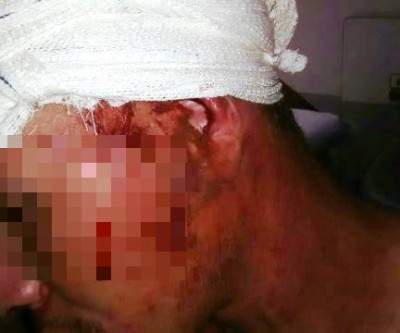 Durante briga, filho é ferido com golpe de foice pelo próprio pai