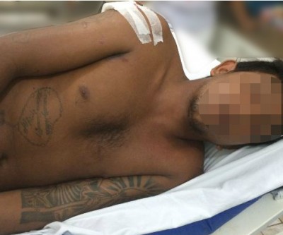 Jovem sofre tentativa de homicídio e diz “vou cobrar essa fita do vacilão”
