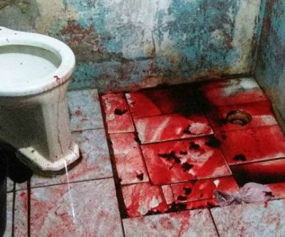Idosa é encontrada gravemente ferida dentro do banheiro de residência